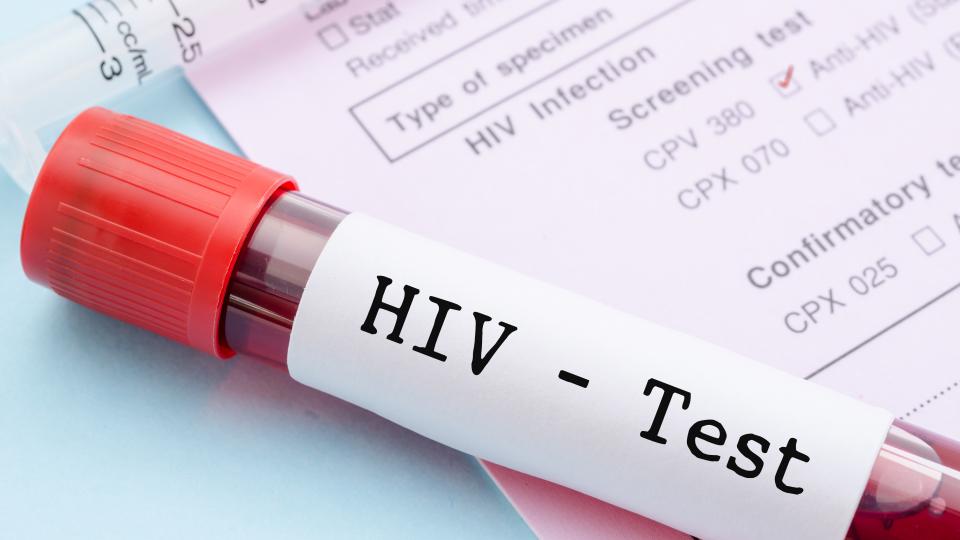 Was ist HIV/AIDS?
